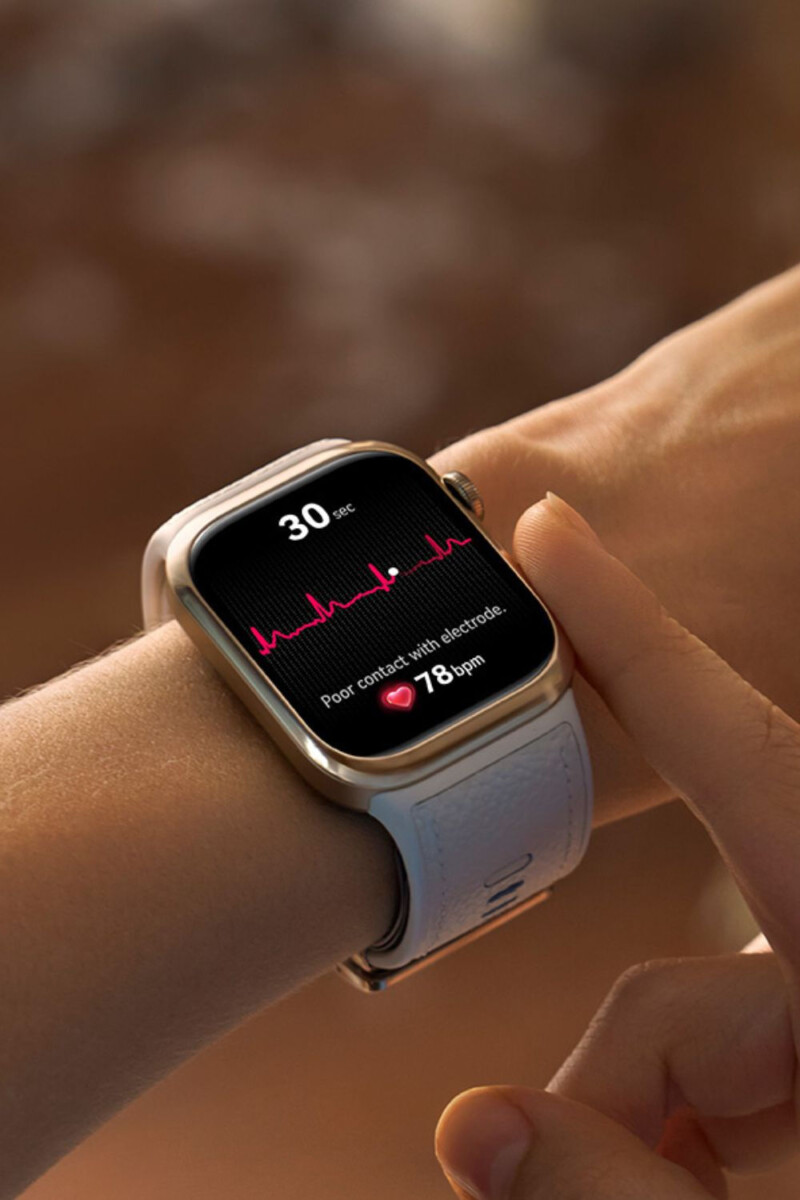 Smartwatch bienfaits photo